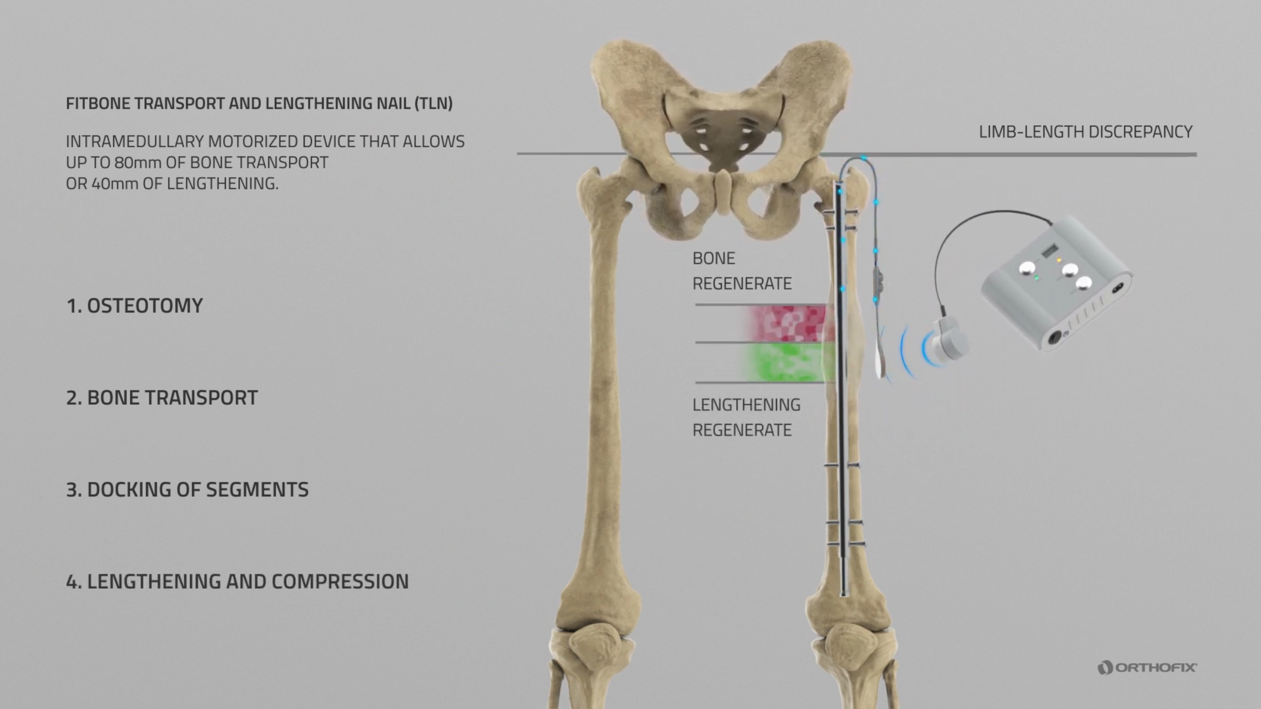 Daily Lengthening Process
