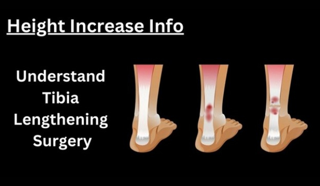 Tibia Lengthening Surgery Solution