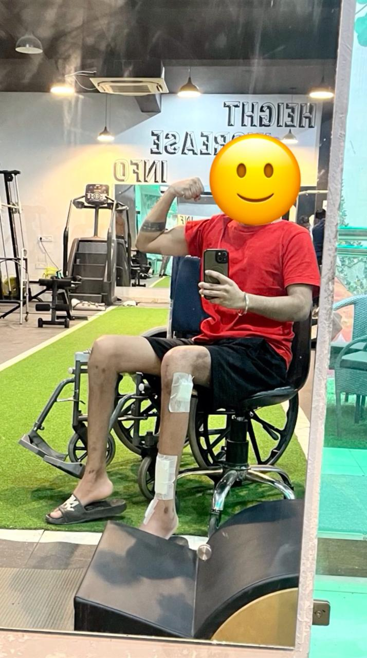 Guided limb lengthening rehabilitation session