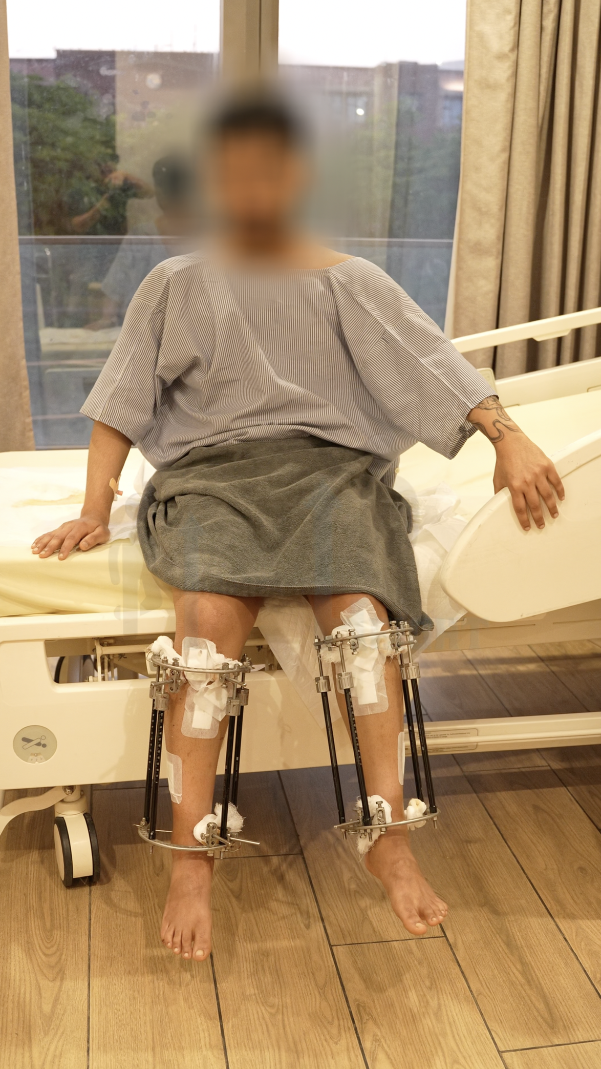 Rehabilitation guidance for safe movement