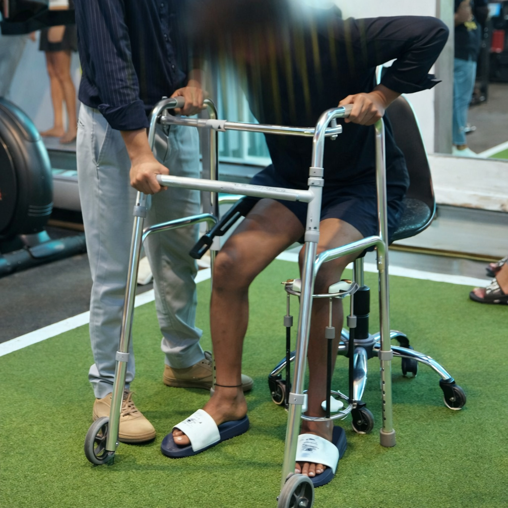 Recovery After Bilateral Tibia Lengthening